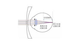 青少年守护苹果版:离焦眼镜新卷王？“思问”了解一下